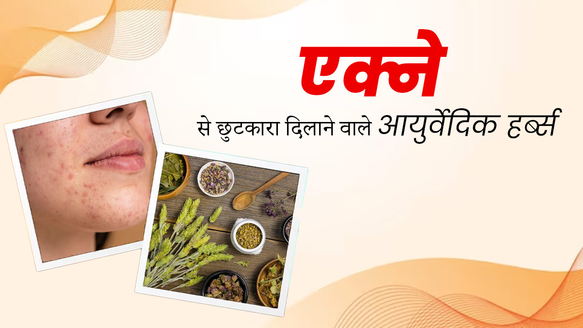 एक्ने से छुटकारा दिलाएंगे ये 3 आयुर्वेदिक हर्ब्स, जानें इस्तेमाल का तरीका