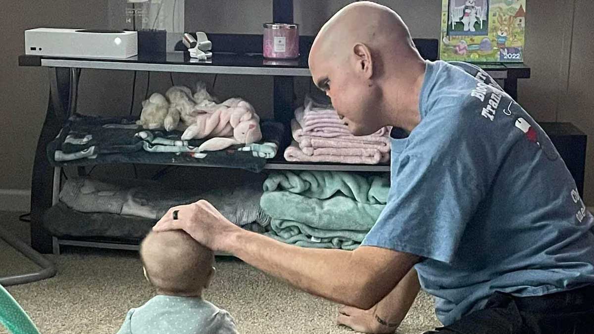 Man Loses Noses Following Fatal Fungal Infection Due To Autoimmune Disorder: Here’s What Is Aplastic Anaemia