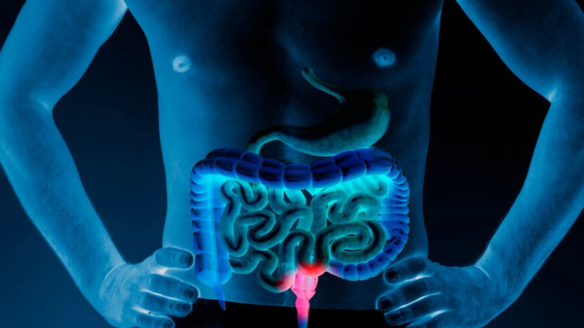 Colon Cancer On The Rise In Young Adults: Here Are Some Modern Lifestyle Habits That May Be The Cause