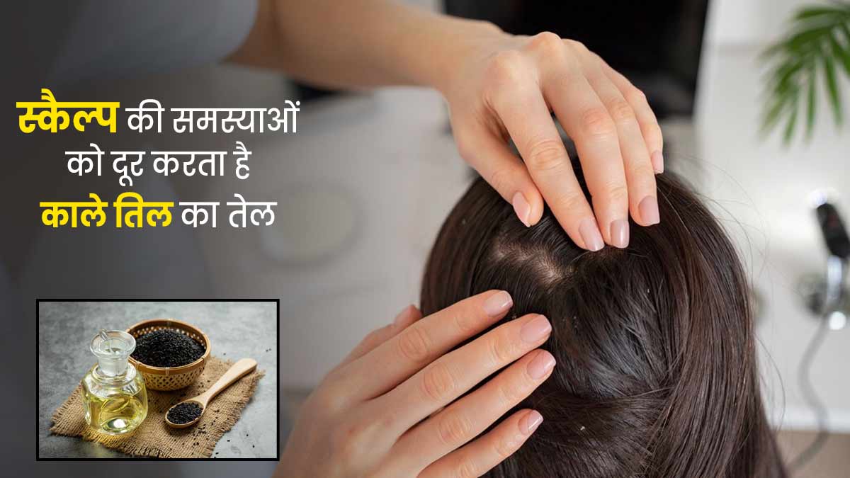  हेल्दी स्कैल्प के लिए लगाएं काले तिल का तेल, ड्राई स्कैल्प और डैंड्रफ से होगी दूर