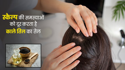  हेल्दी स्कैल्प के लिए लगाएं काले तिल का तेल, ड्राई स्कैल्प और डैंड्रफ से होगी दूर