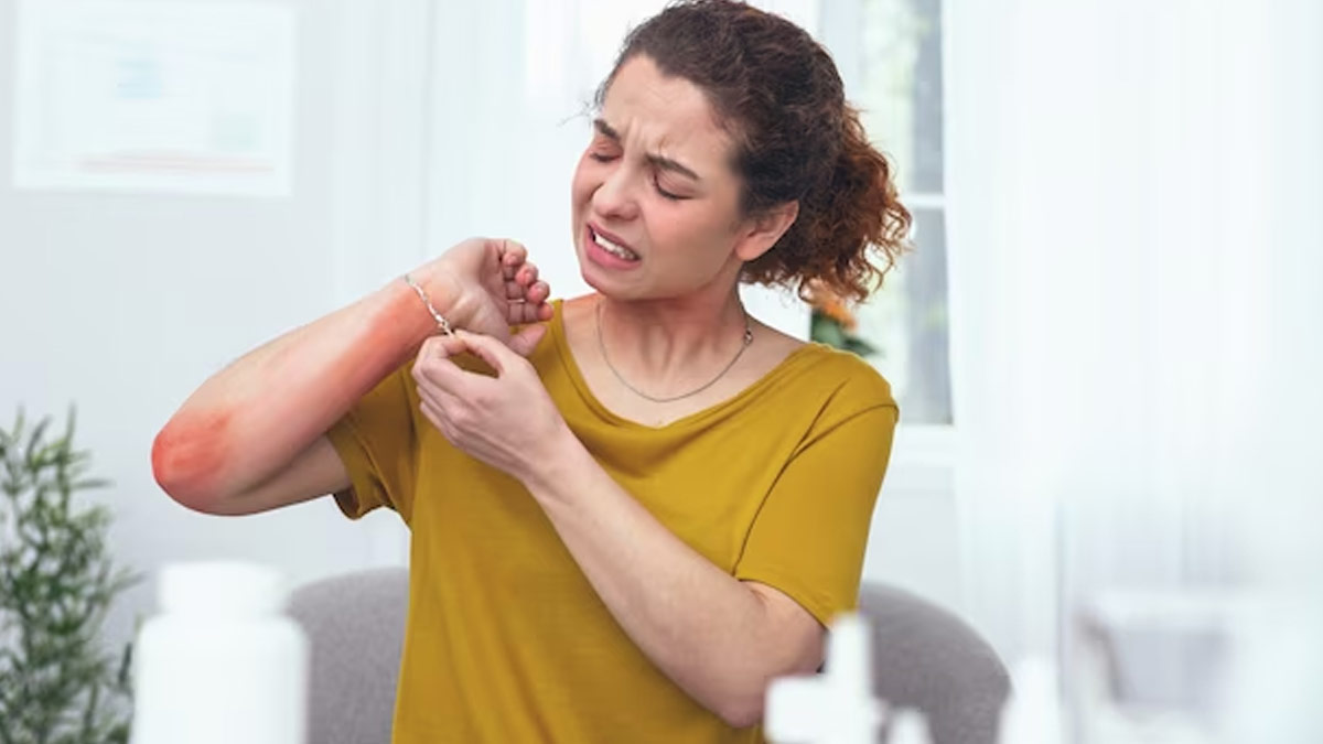 What Is The Difference Between Seasonal Allergies And Food Allergies In Hindi