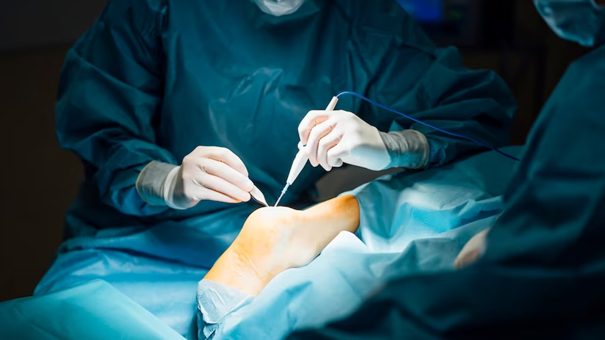 Triceps Surgery in Hindi