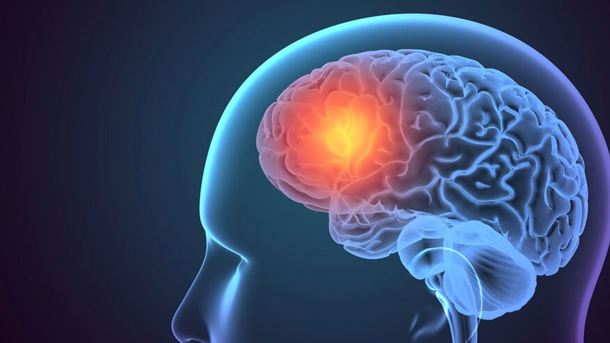 Did You Know That Other Conditions Can Also Resemble a Stroke? Here’s How You Can Differentiate