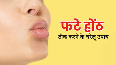 Chapped Lips Remedies: फटे होंठों की समस्या दूर करने के लिए अपनाएं डॉक्टर के बताए ये घरेलू उपाय