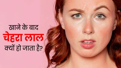 खाने के बाद लाल हो जाता है चेहरा? डॉक्‍टर से समझें इसका कारण 