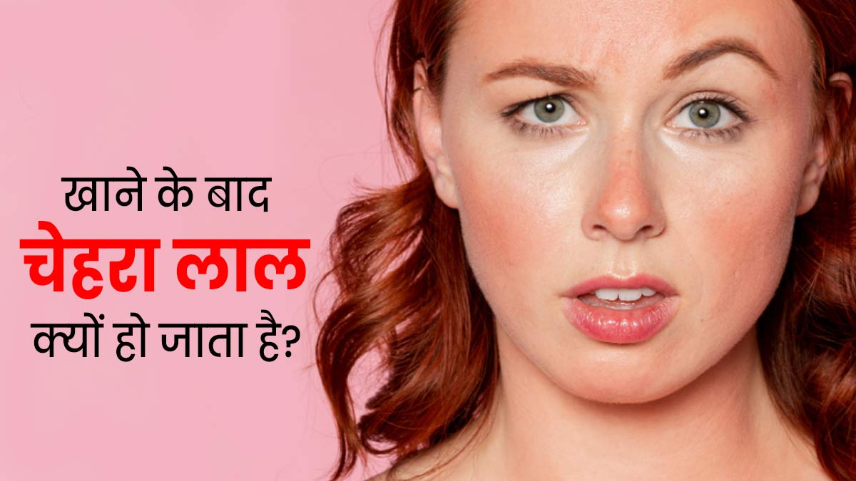 खाने के बाद लाल हो जाता है चेहरा? डॉक्‍टर से समझें इसका कारण 