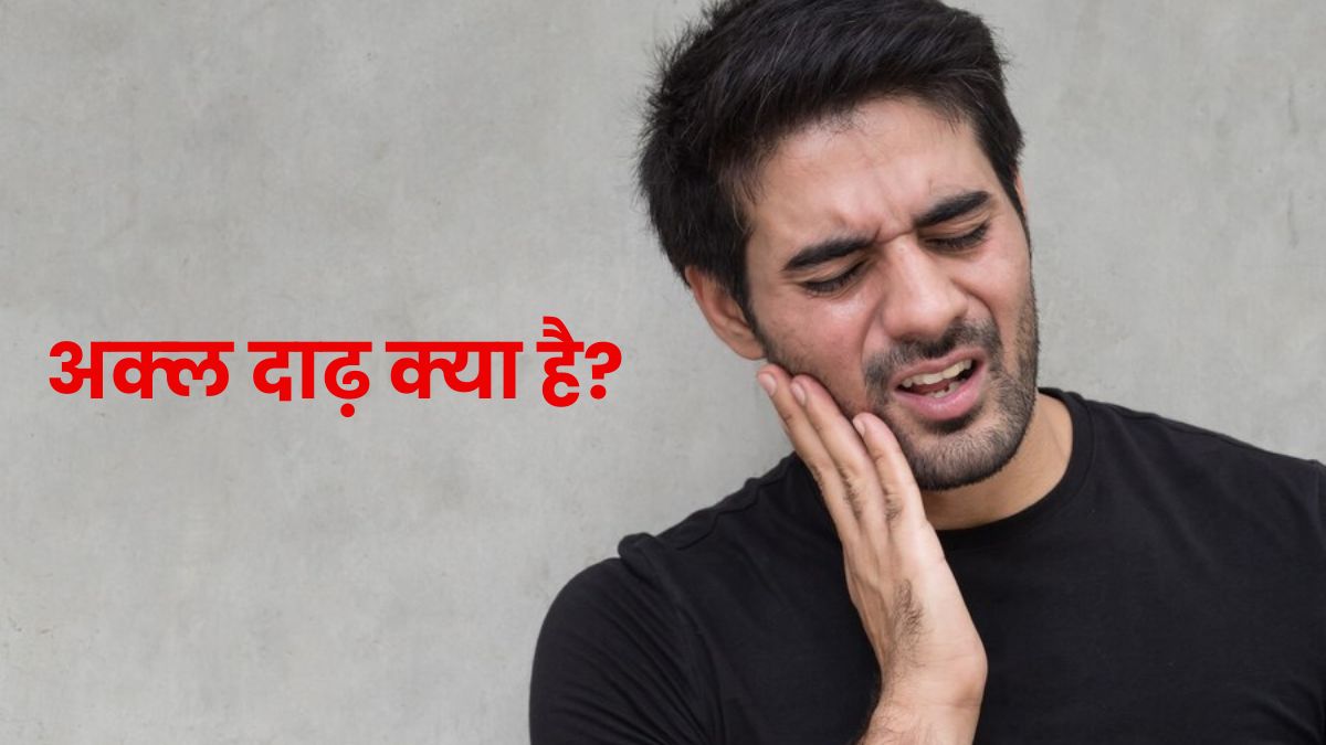 विस्‍डम टीथ (अक्‍ल दाढ़) क्या है? जानें इससे जुड़ी जरूरी बातें
