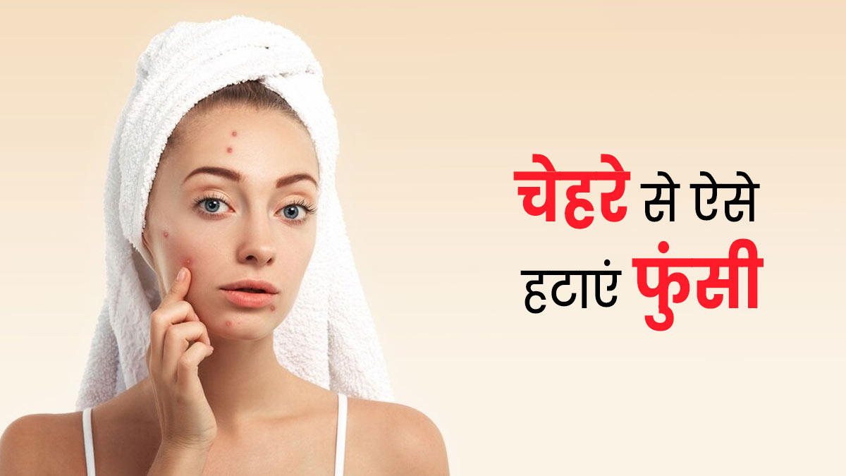 चेहरे से फुंसी कैसे हटाएं? जानें इन्हें हटाने रामबाण तरीका 
