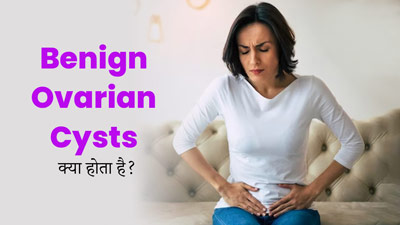 Benign Ovarian Cysts: बिनाइन ओवेरियन सिस्ट क्या होता है? डॉक्टर से जानें इसके लक्षण और इलाज