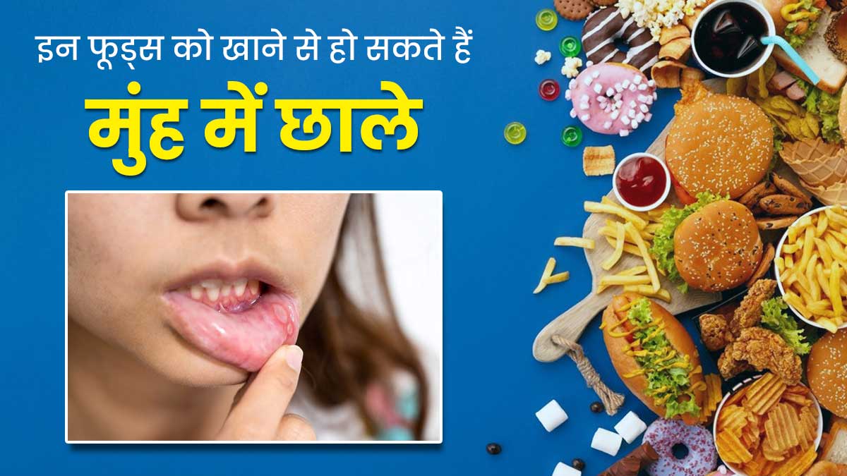 मुंह में छाले का कारण बनते हैं ये 5 फूड्स, जानें क्यों करना चाहिए इनसे परहेज