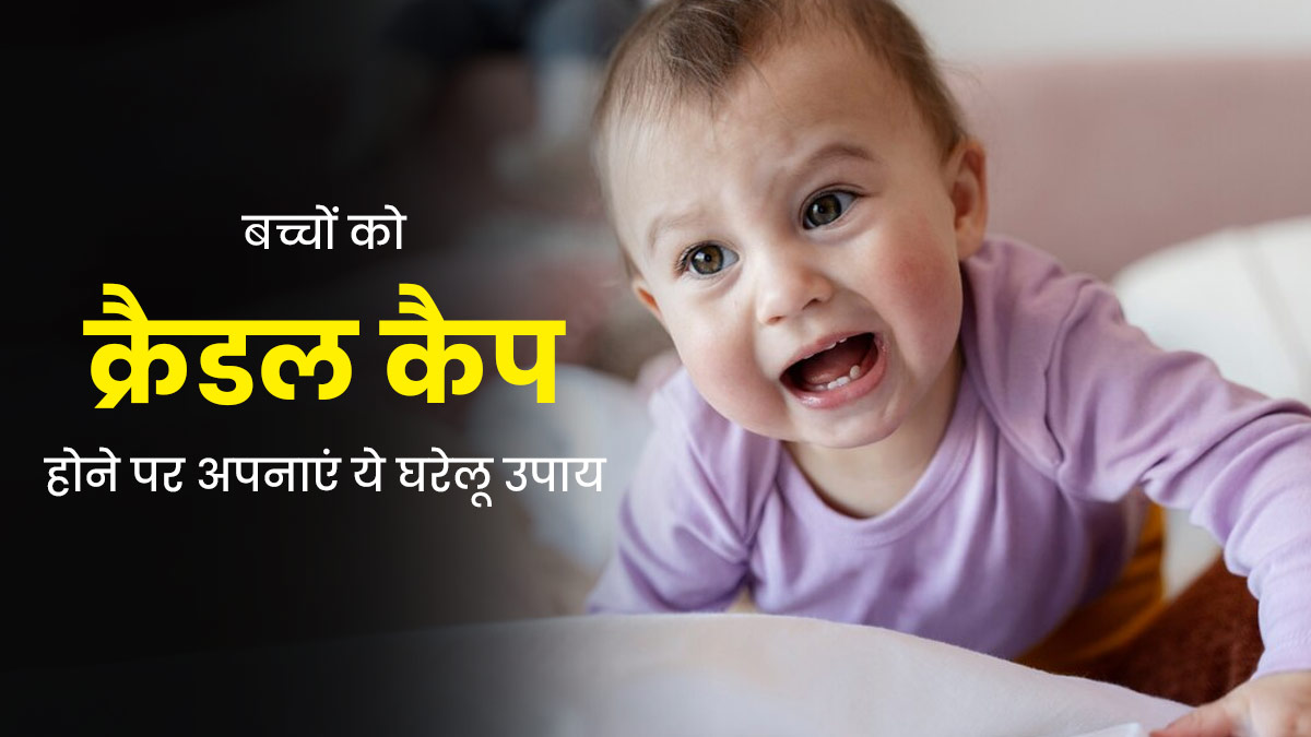 बच्चों को क्रैडल कैप होने पर अपनाएं ये घरेलू उपाय, जल्द मिलेगा आराम
