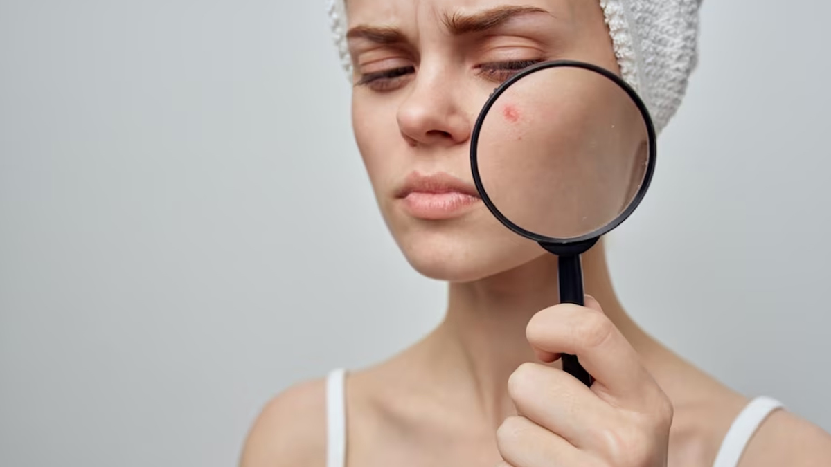 Benefits-of-applying-celery-leaves-on-face-ins