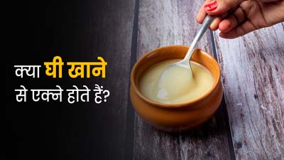 क्‍या घी खाने से कील-मुंहासे होते हैं? एक्‍सपर्ट से जानें 