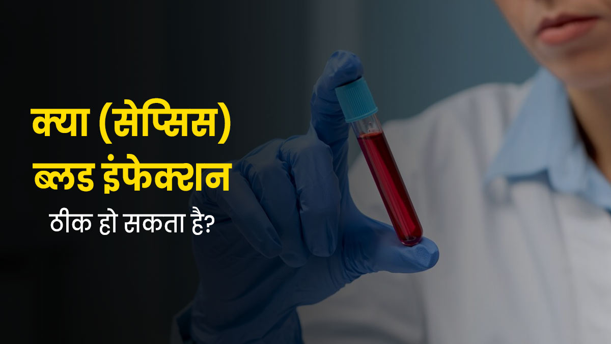 क्‍या (सेप्‍स‍िस) ब्लड इंफेक्शन ठीक हो सकता है? डॉक्‍टर से जानें 