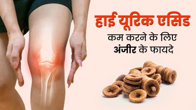 हाई यूरिक एसिड में करें अंजीर का सेवन, मिलेगा फायदा