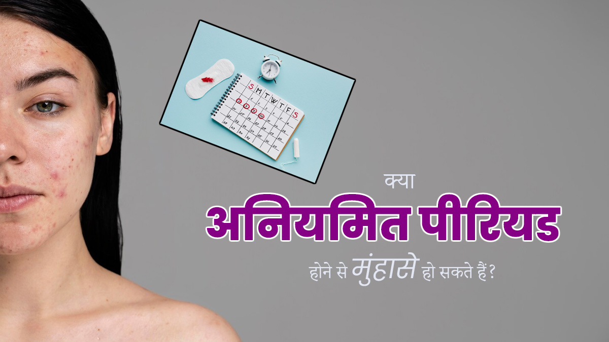 क्या अनियमित पीरियड्स की वजह से चेहरे पर कील-मुंहासे हो सकते हैं? जानें डॉक्टर से