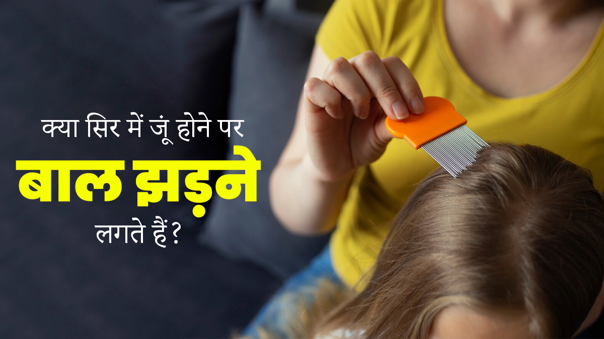 क्या सिर में जूं होने पर बाल झड़ने लगते हैं? एक्सपर्ट से जानें