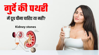 गुर्दे की पथरी में दूध पीना चाहिए या नहीं? एक्सपर्ट से जानें जवाब