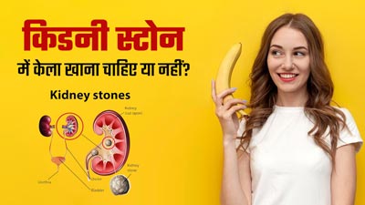 किडनी स्टोन में केला खाना चाहिए या नहीं? जानें क्या कहते हैं एक्सपर्ट