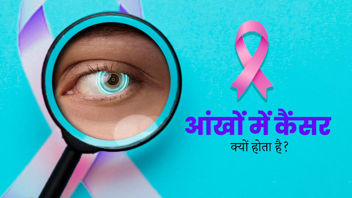 आंखों में कैंसर क्यों होता है? डॉक्टर से जानें इसका लक्षण और इलाज