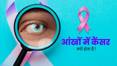 आंखों में कैंसर क्यों होता है? डॉक्टर से जानें इसका लक्षण और इलाज