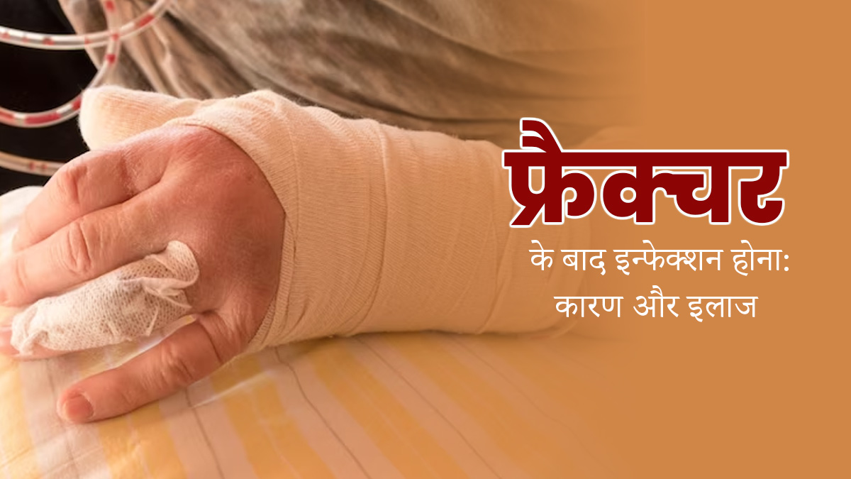 फ्रैक्‍चर के बाद हो सकता है इन्‍फेक्‍शन, डॉक्‍टर से समझें संक्रमण का कारण और इलाज 