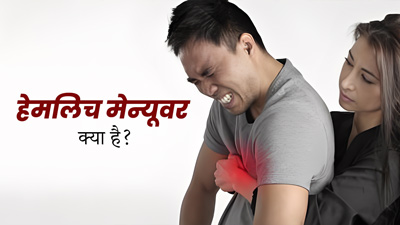 Heimlich Maneuver क्या है? दम घुटने पर जान बचाने में करता है मदद