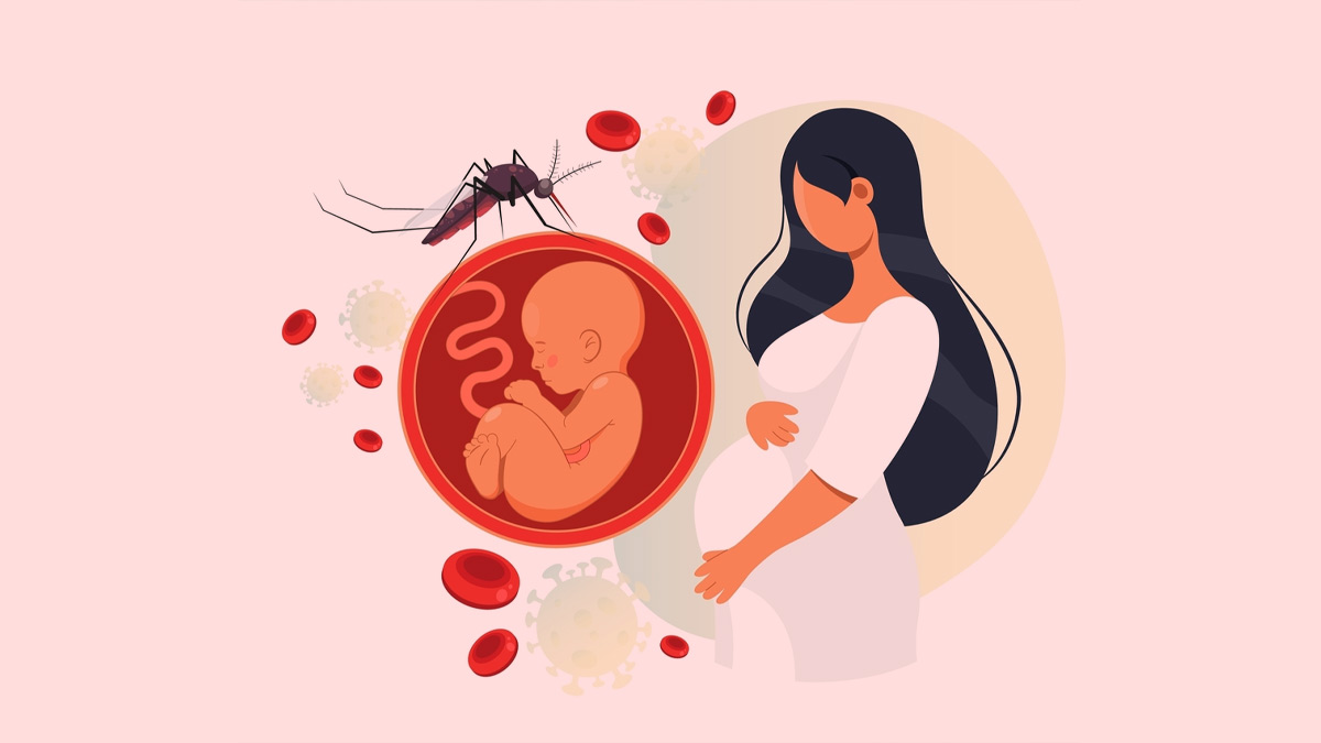 Pune Reports 1st Case of Pregnant Woman With Zika Virus: Learn About Its Risks During Pregnancy
