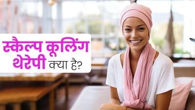 कीमोथेरेपी के बाद बालों को झड़ने से बचाने में कारगर है स्कैल्प कूलिंग थेरेपी, जानें इसके फायदे