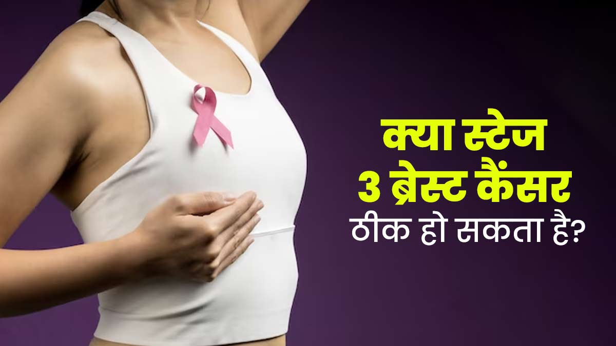 क्या स्टेज 3 ब्रेस्ट कैंसर का इलाज संभव है? जानें ठीक होने की कितनी होती है संभावना