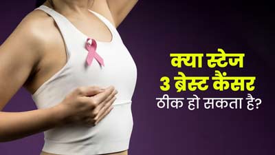 क्या स्टेज 3 ब्रेस्ट कैंसर का इलाज संभव है? जानें ठीक होने की कितनी होती है संभावना