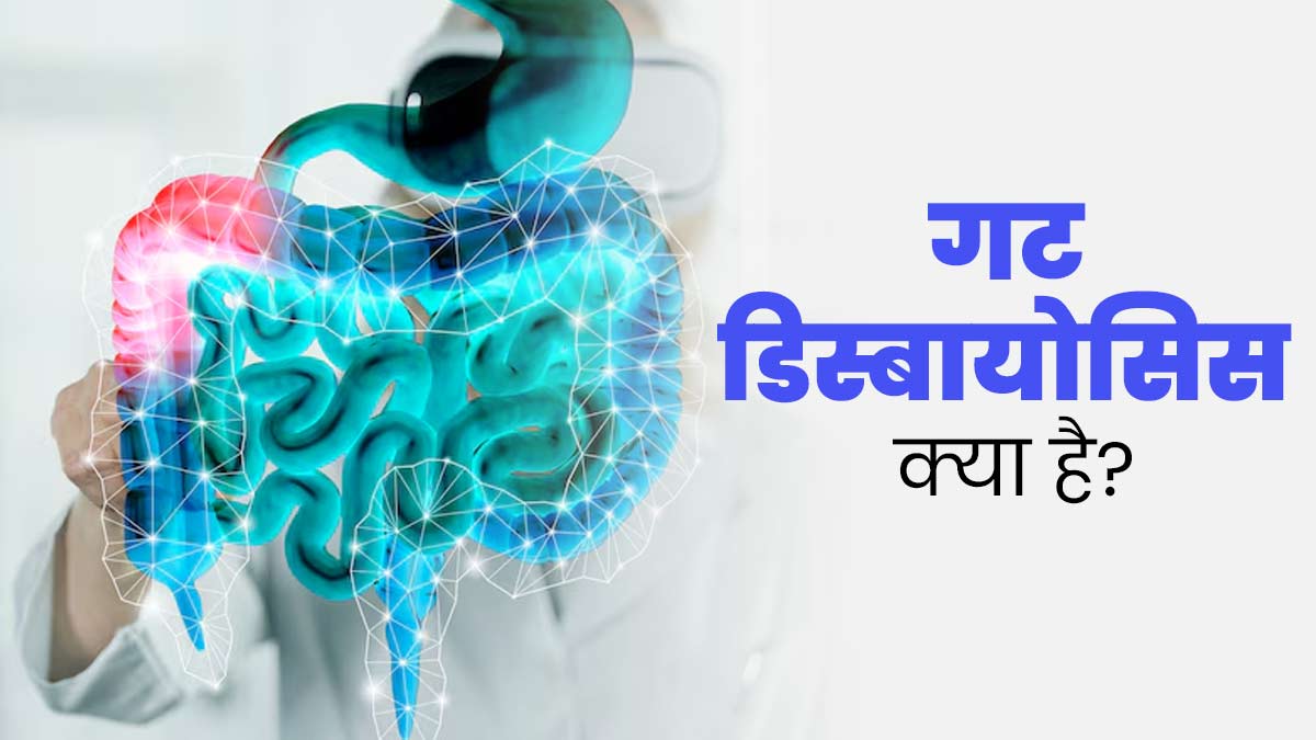 गट डिस्बायोसिस क्या है? एक्सपर्ट से जानें इसके लक्षण और राहत पाने के तरीके 