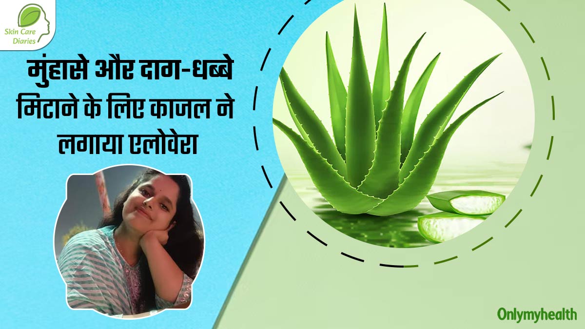 चेहरे के मुंहासे और दाग-धब्बे मिटाने के लिए काजल ने इस्तेमाल किया एलोवेरा, आप भी कर सकते हैं ट्राई