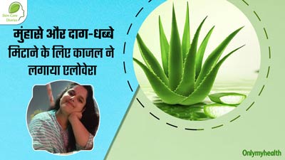 चेहरे के मुंहासे और दाग-धब्बे मिटाने के लिए काजल ने इस्तेमाल किया एलोवेरा, आप भी कर सकते हैं ट्राई