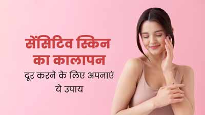 सेंसिटिव स्किन का कालापन दूर करने के लिए अपनाएं ये 5 आसान उपाय, दाग-धब्बे भी होंगे दूर