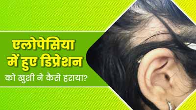 एलोपेसिया एरीटा के कारण डिप्रेशन का शिकार हो गई थी 13 साल की खुशी, जानें कैसे दी इसे मात?