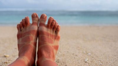 Dealing With Tanned Feet this Summer? Try These Home Remedies