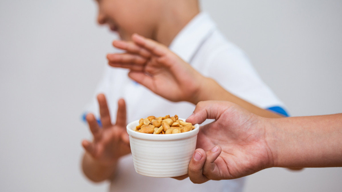 7 Food Allergy Symptoms To Watch Out For In Children