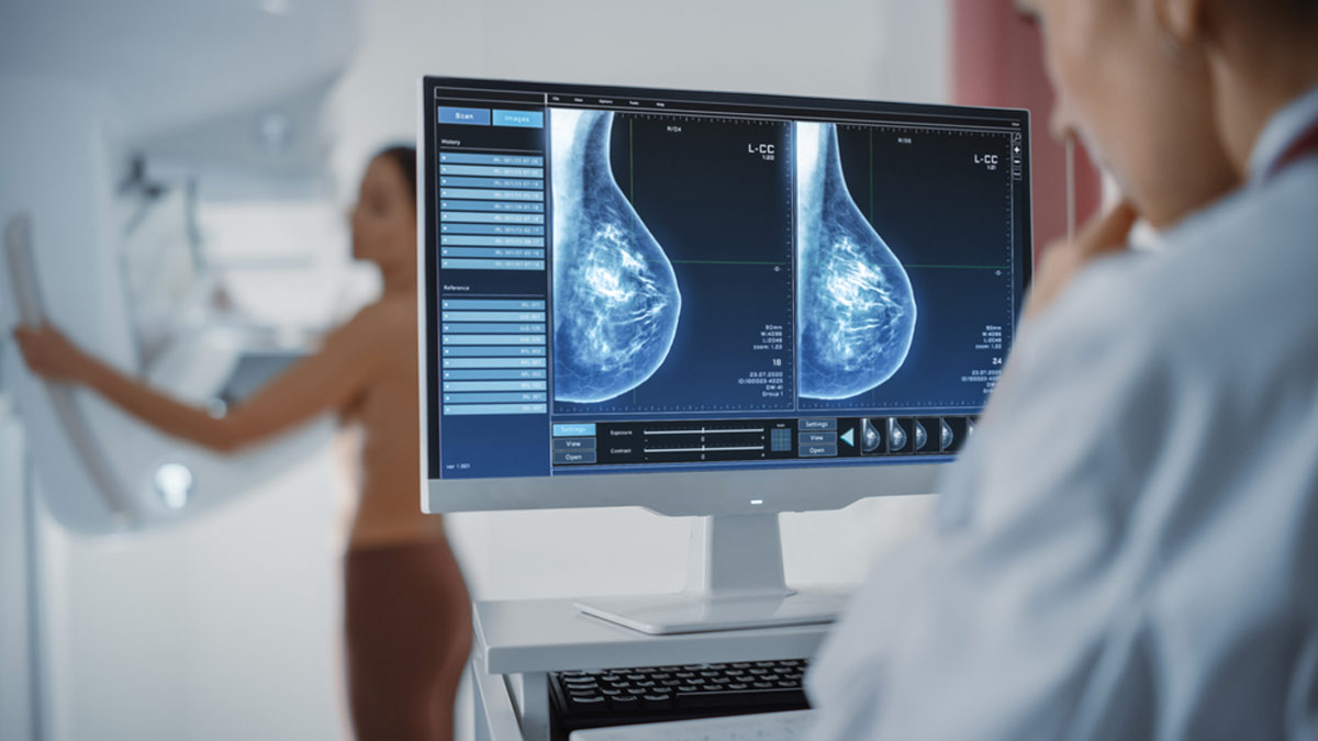 Do Mammograms Hurt? Here's What To Expect During The Procedure