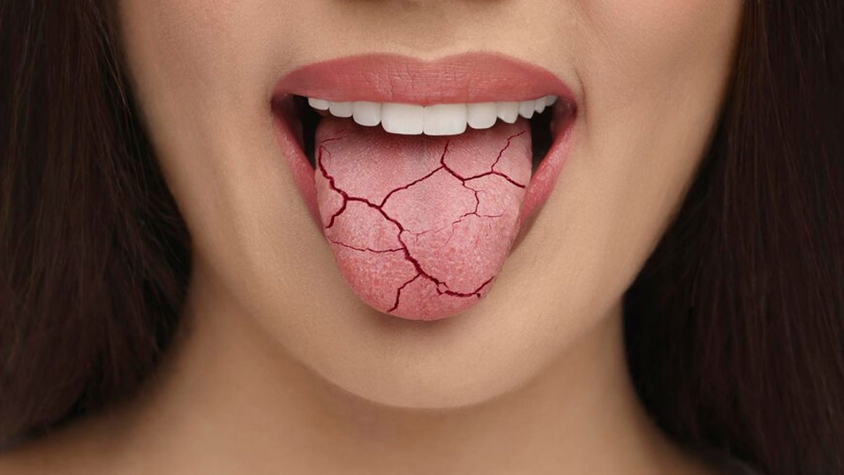 क्‍या उम्र बढ़ने पर मुंह सूखने की समस्‍या होना आम है? डॉक्टर से जानें 