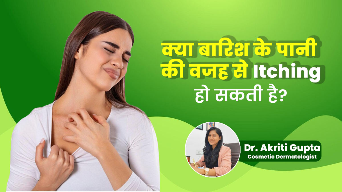 Itchy Skin: क्या बारिश के पानी की वजह से त्वचा में खुजली की समस्या हो सकती है? जानें बचाव के उपाय