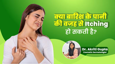 Itchy Skin: क्या बारिश के पानी की वजह से त्वचा में खुजली की समस्या हो सकती है? जानें बचाव के उपाय