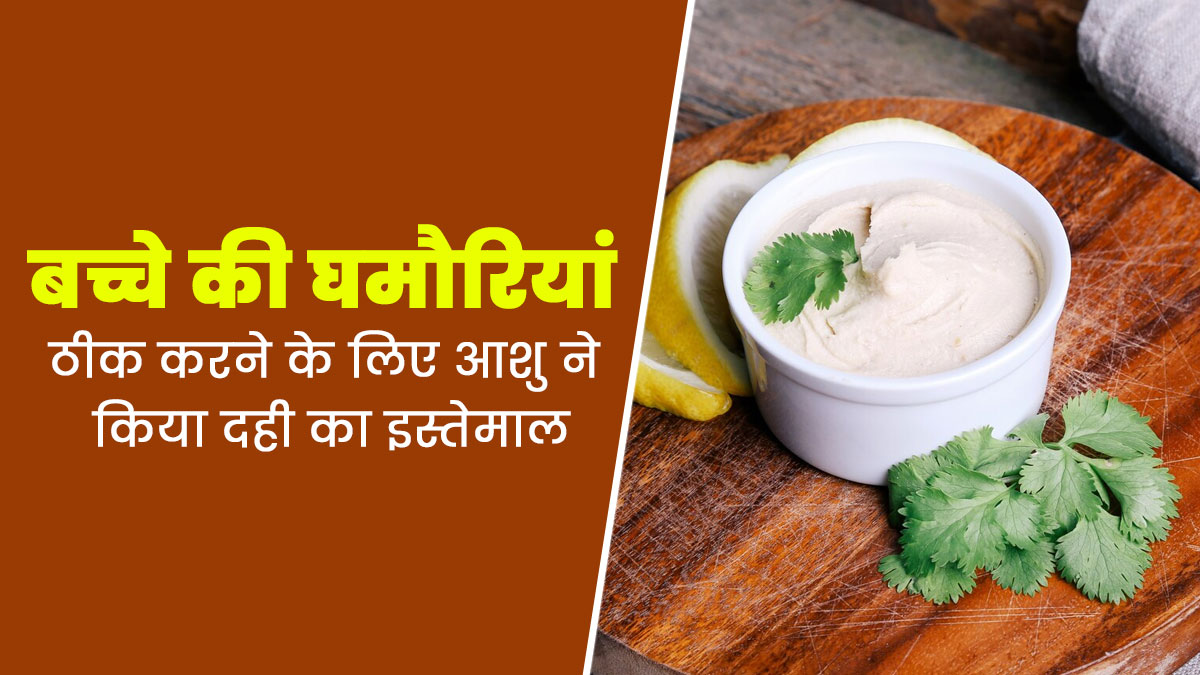OMH Self Tried : बच्चे की घमौरियां ठीक करने के लिए आशु ने किया दही का इस्तेमाल, आप भी जानें तरीका