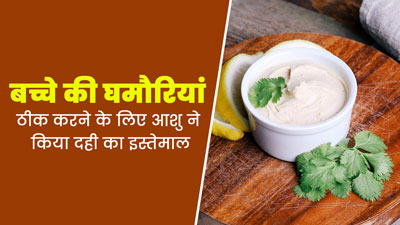 OMH Self Tried : बच्चे की घमौरियां ठीक करने के लिए आशु ने किया दही का इस्तेमाल, आप भी जानें तरीका