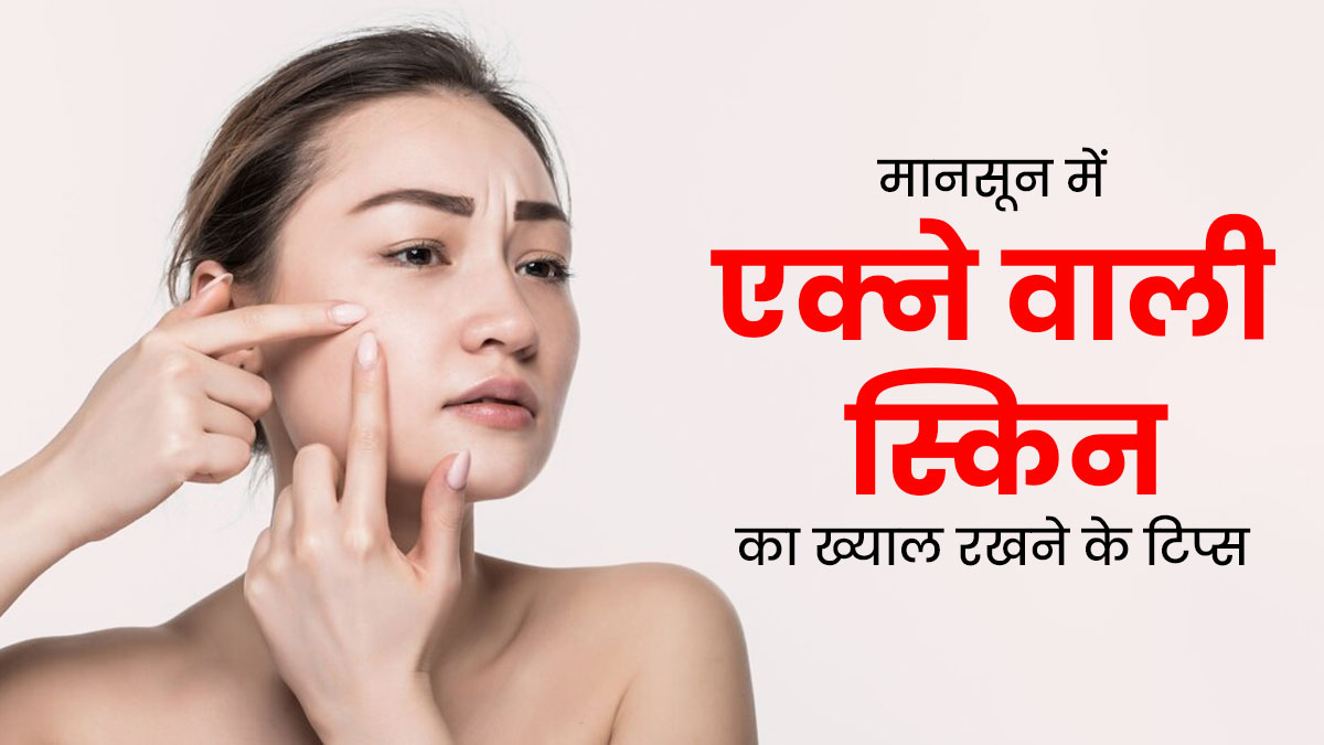 एक्ने वाली स्किन है तो मानसून में फॉलो करें ये स्किनकेयर टिप्स, त्वचा पर आएगा निखार