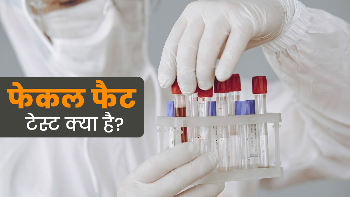 शरीर में कहां जमा है चर्बी, फेकल फैट टेस्ट से चलेगा पता, डॉक्टर से जानें इसके बारे में