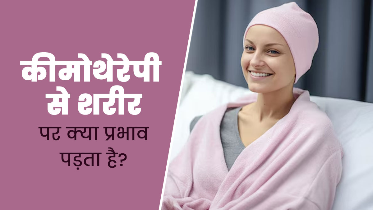 कीमोथेरेपी का शरीर पर क्या प्रभाव पड़ता है? डॉक्टर से जानें
