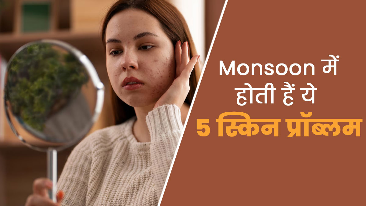 मानसून में होती हैं त्वचा से जुड़ी ये 5 समस्याएं, इन तरीकों से पाएं छुटकारा
