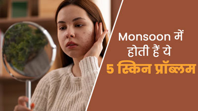 मानसून में होती हैं त्वचा से जुड़ी ये 5 समस्याएं, इन तरीकों से पाएं छुटकारा